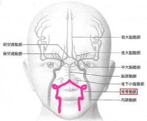 椎骨動脈低形成について | WEB脳神経外科